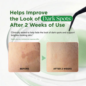 2-week skin transformation for dark spots