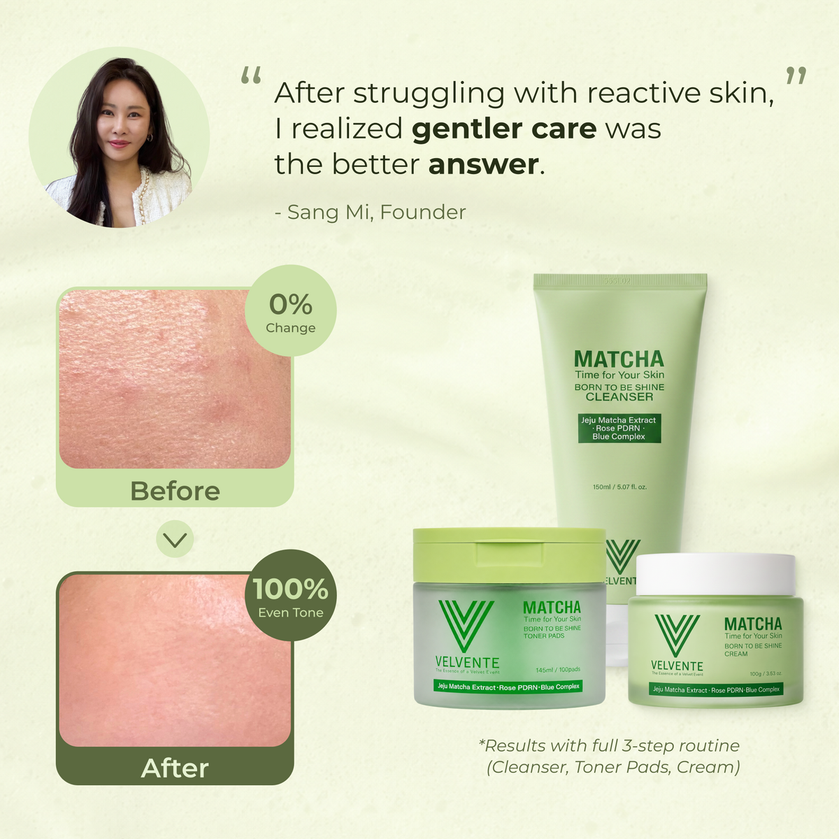 The V-Renewal System