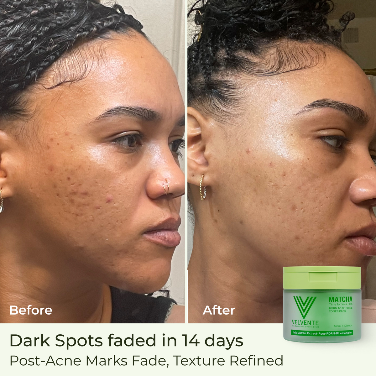 Toner Pads