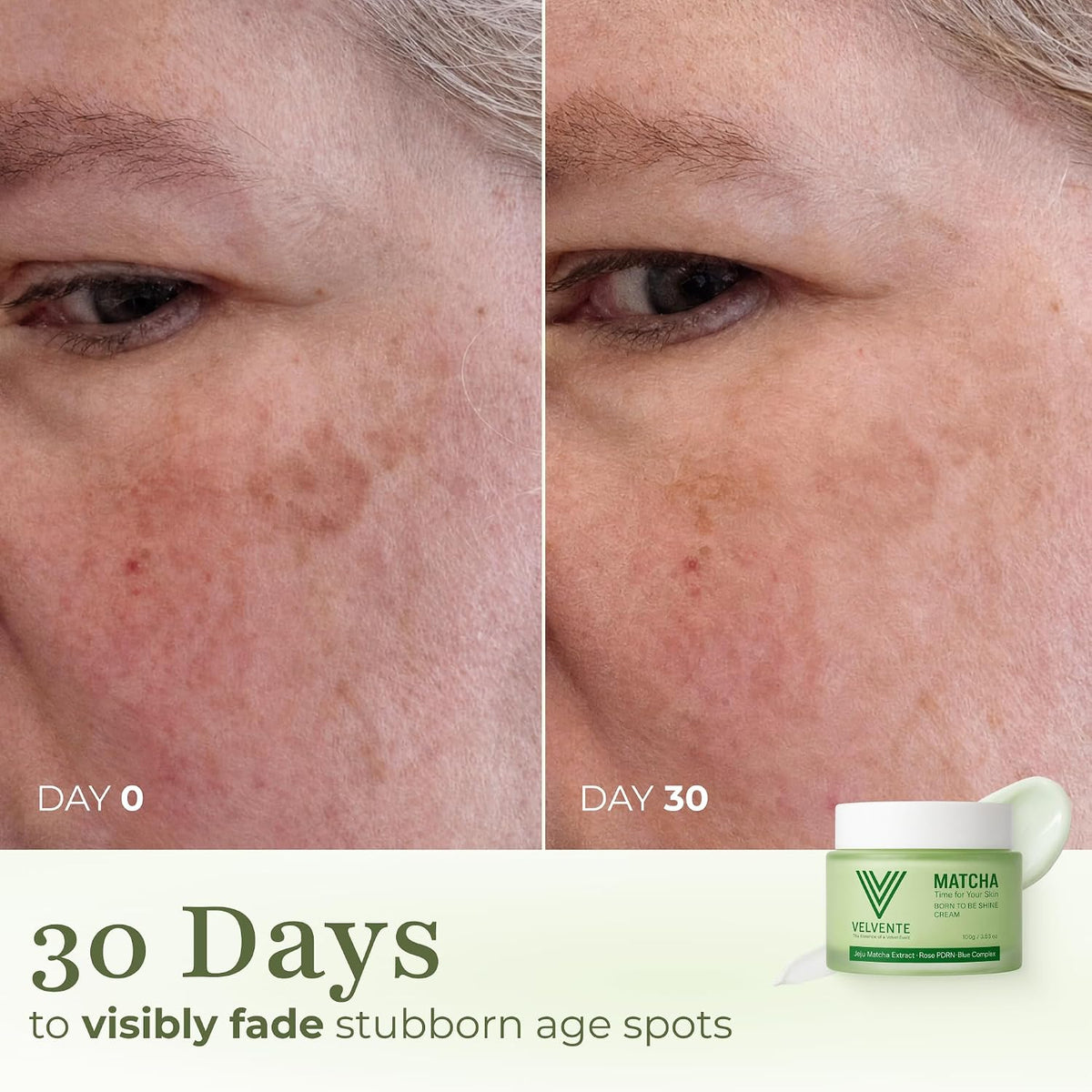 Toner Pads