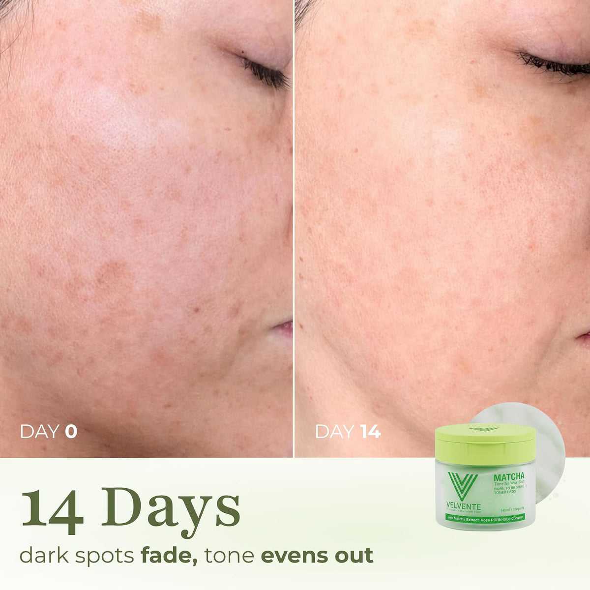 Toner Pads