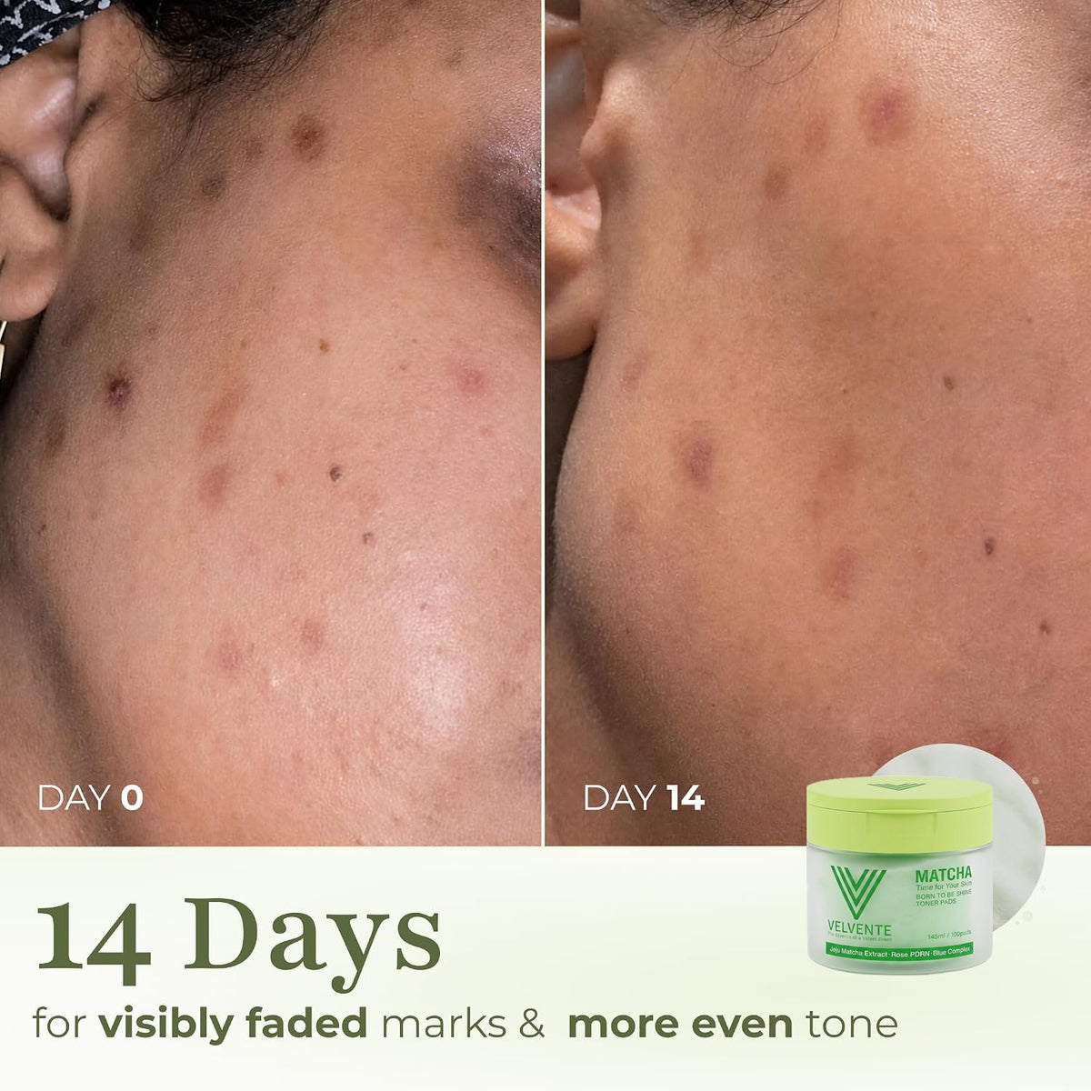 Toner Pads